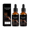 Black Sesame Hair Growth Serum with Caffeine Ginger Extract 30ml Natural Scalp Nourishment Oil Hair Stronger Roots Thickening