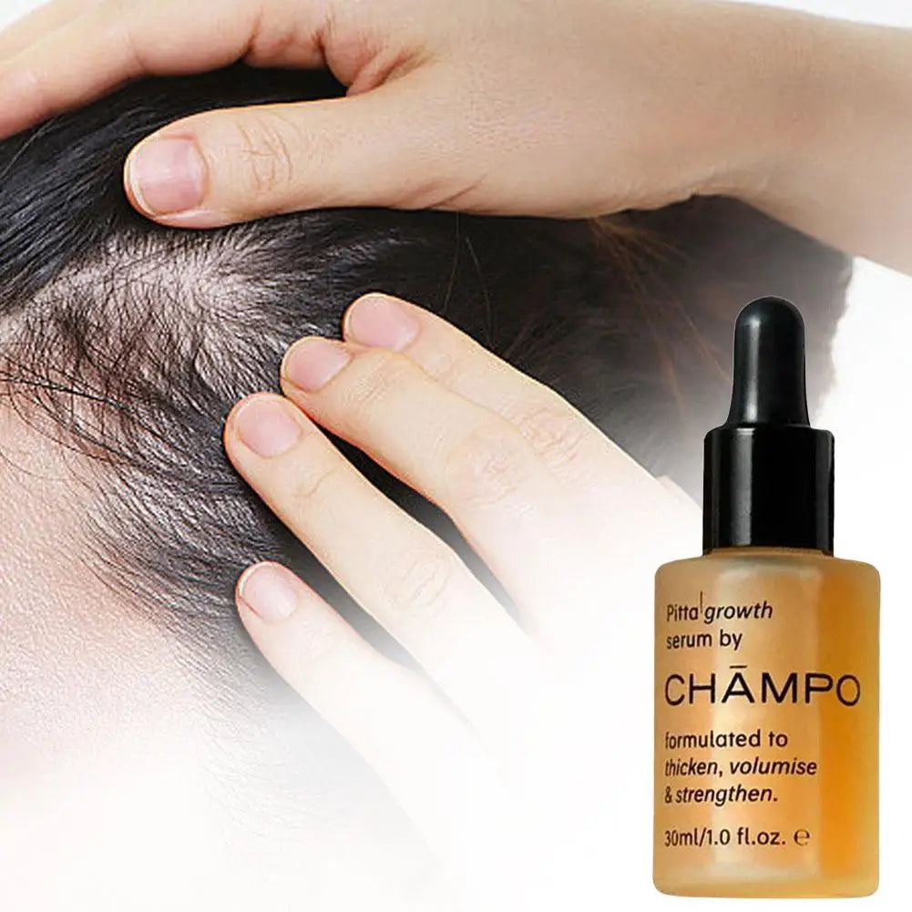 CHĀMPO Pitta Growth Hair Serum 30ml,Volumizing & Strengthening Hair Oil,Nourishing & Repairing Treatment for Fuller Thicker Hair