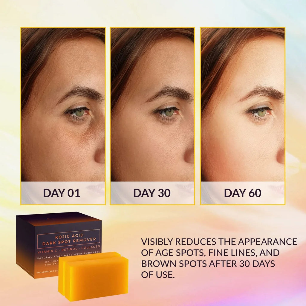 Kojic Acid Dark Spot Remover Whitening Soap Handmade Skin Care Deep Cleaning Moisturizing Cleansing Essential Soap Brighten Skin