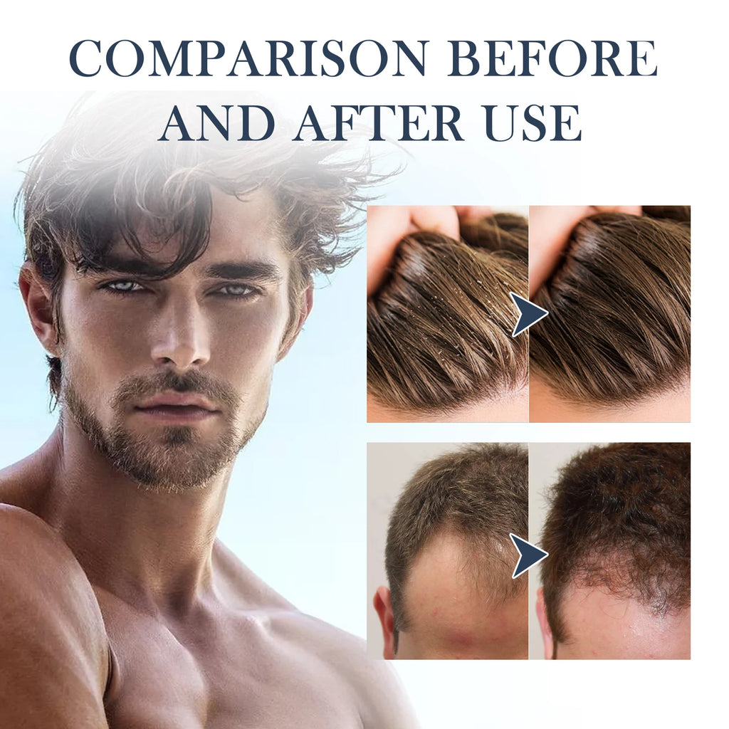 Collagen Shampoo Dandruff Control Oil Refreshing Nourishing Hair Root Repair Damaged Reduce Dry Shampoo Suitable For Men