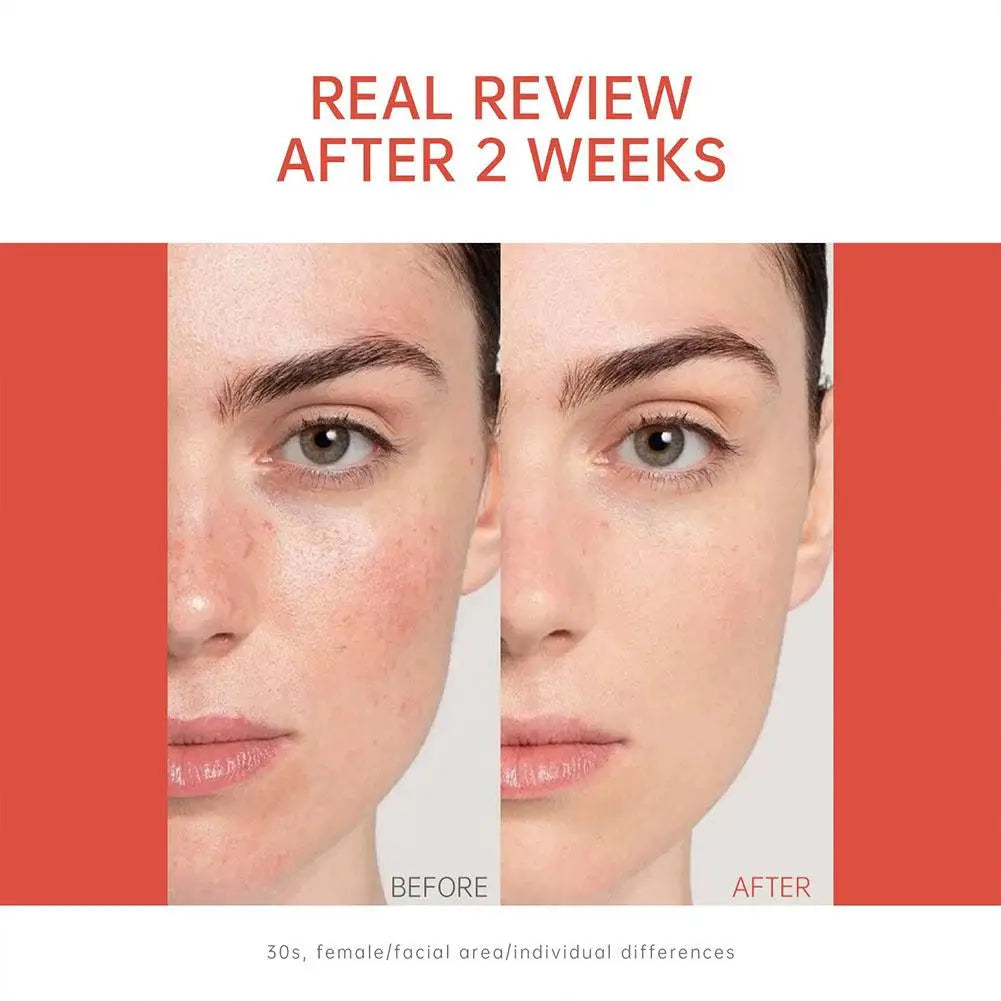 PDRN Salmon DNA Facial Serum Deeply Nourishing The Skin Skin Elasticity Ampoule Essence Smoothing Glow Boosting Skin-firming