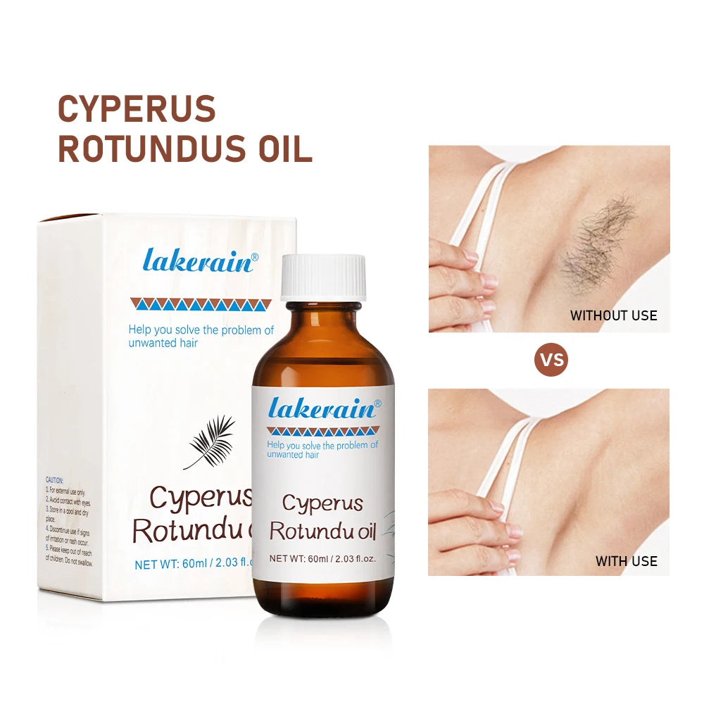 60ml Cyperus Rotundus Oil Nourish the Skin Ingredients are Safe Inhibit Hair Growth Wide Scope of Application Solve Hair Dense P