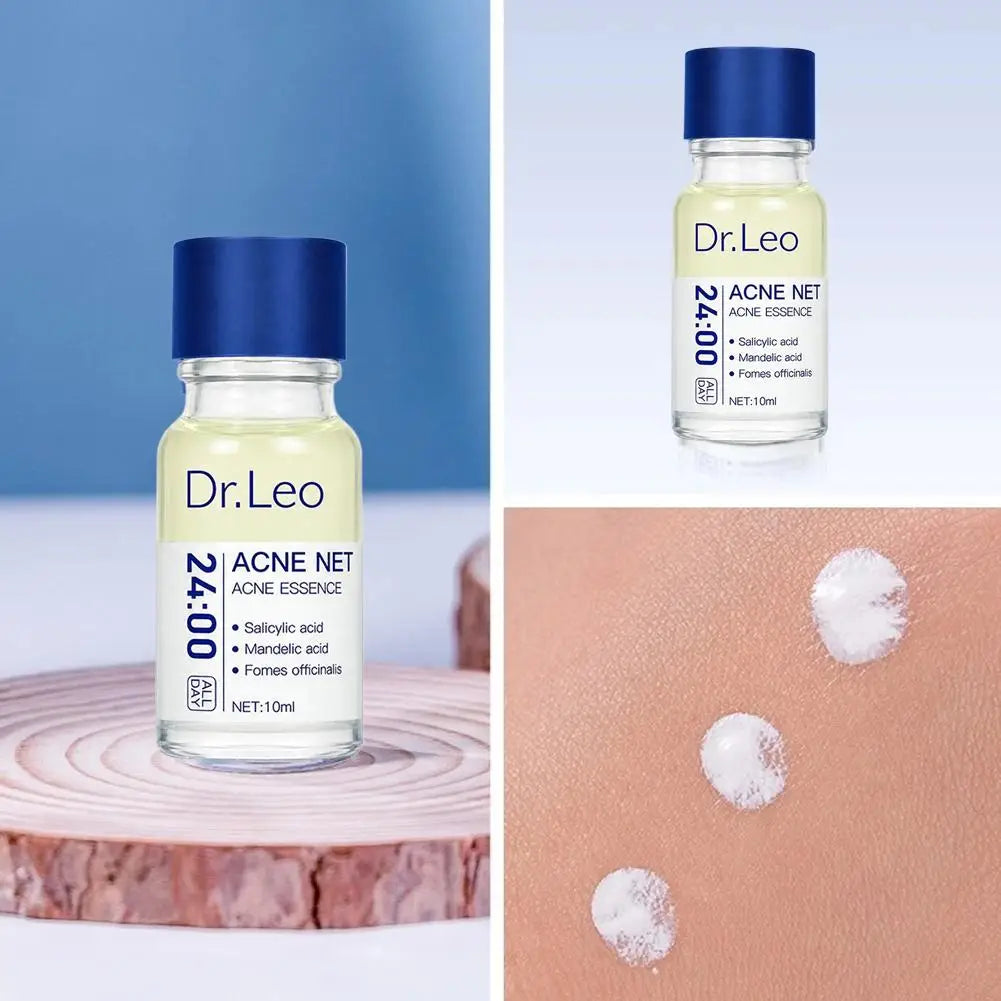 Salicylic Acid Acne Serum Pimple Spot Corrector Mandelic Acid Pore Refining Sebum Control Essence for Oily Blemish Skin