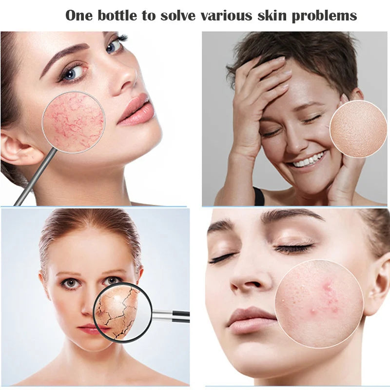 250ml Korean Hyaluronic Acid Collagen Anti-Aging Face Essence Moisturizing Multi-functional Skin Care Product Fade Fine Repair
