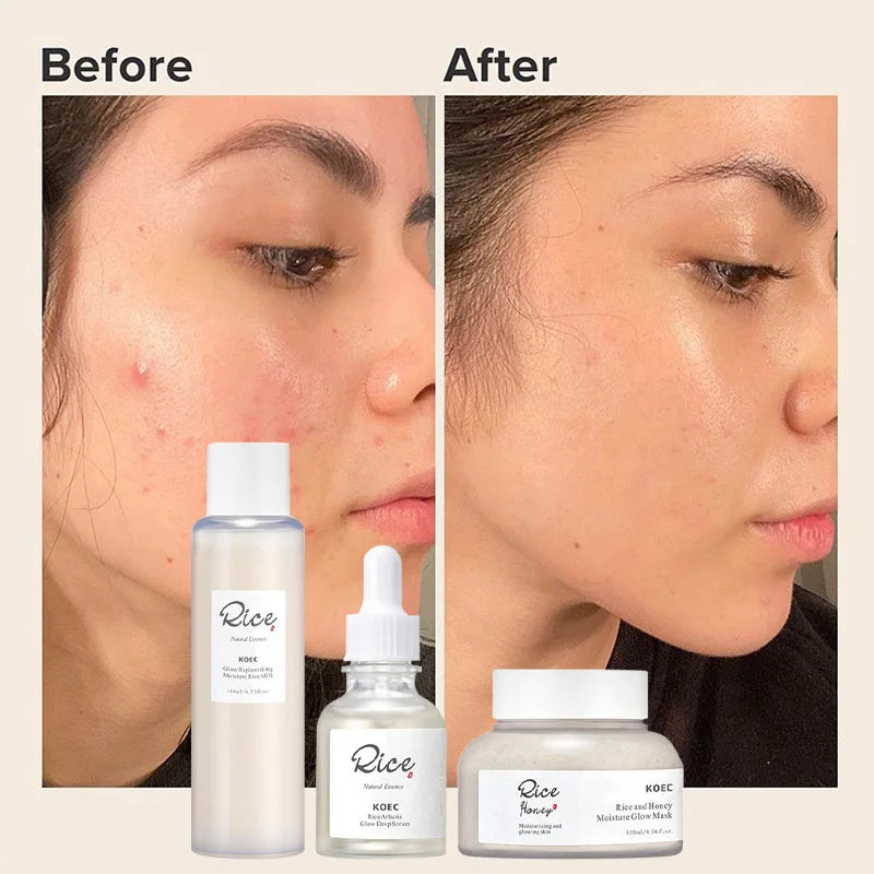 Korean Brand Rice And Honey Skincare Set For Women Oil Control Lifts, Firms, Effective Lightening Skin Care Face Cream Essence