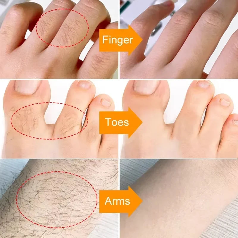 3 Minutes Fast Hair Removal Cream Painless Hair Growth Inhibitor Lip Face Arm Armpit Leg Permanent Depilatory for Men Women Care