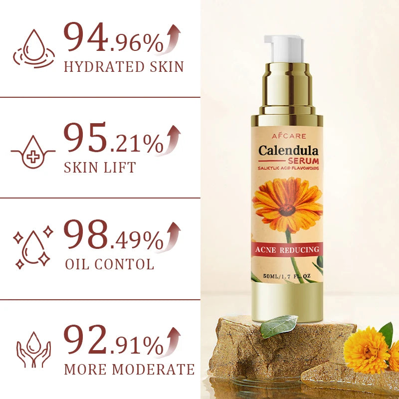 Facial Calendula Serum Natural Essence Contains Salicylic Acid Skin Improve Dry And Rough Skin Korean Face Skincare Product
