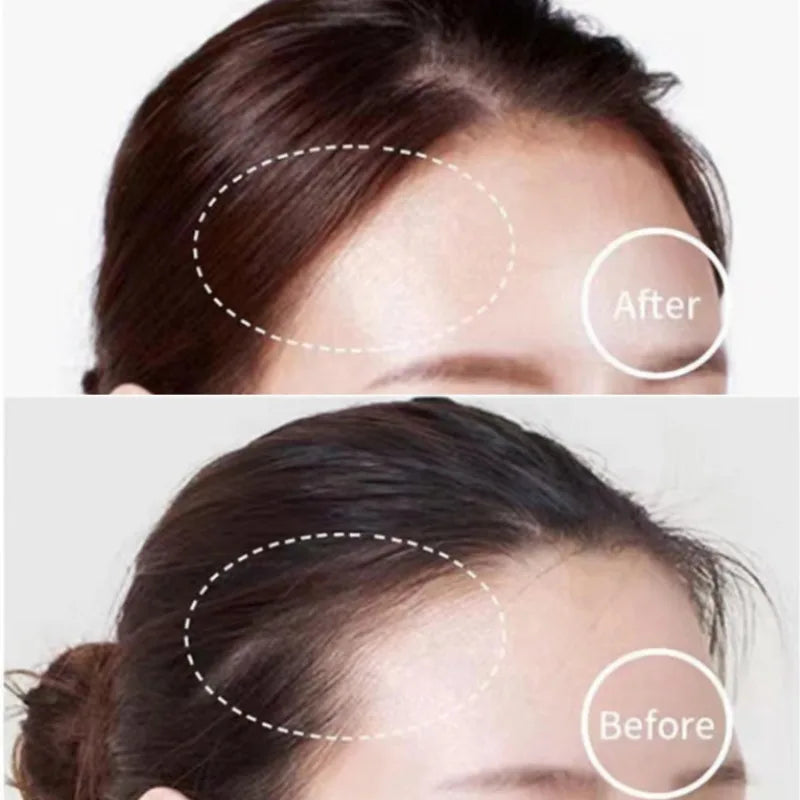 Hairline Contouring Shadow Covers White Hair, Corrects Bald Head, Repairs Hair Powder Cream Artifact, Covers High Forehead
