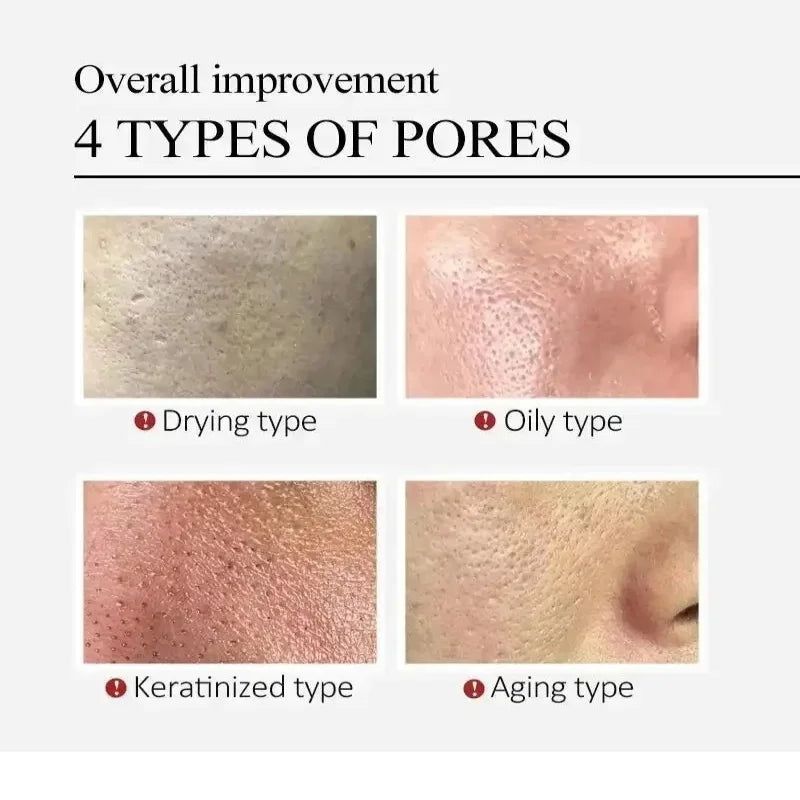 Salicylic Acid Pores Refining Cream Shrink Pore Lmprove Whitening Anti-aging Cream Face Acnes Cream 20g Skin Care