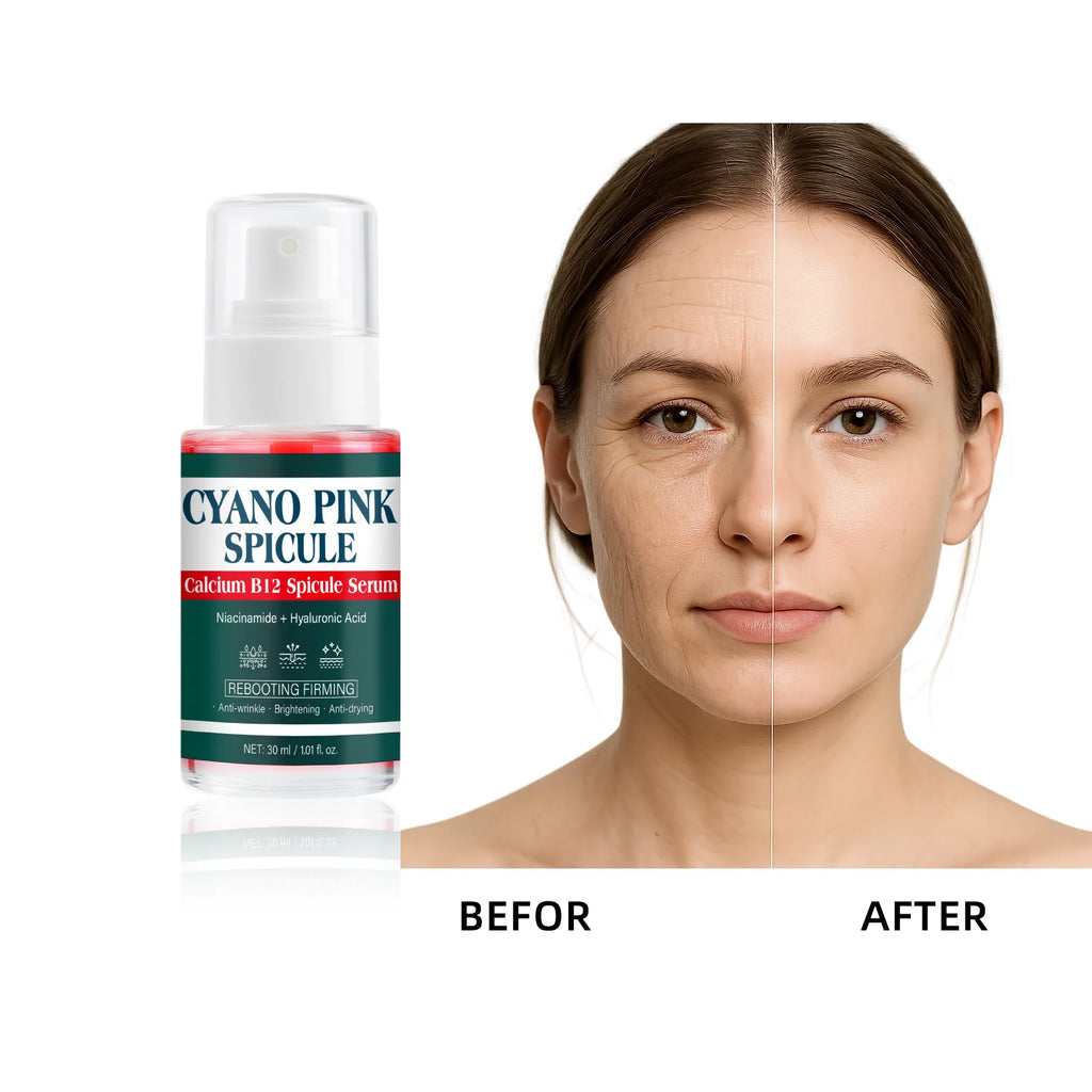 Cyano Pink Spicule Serum Calcium B12 Facial Essence with Niacinamide Hyaluronic Acid Brightening Hydrating Firming Face Serum Mo