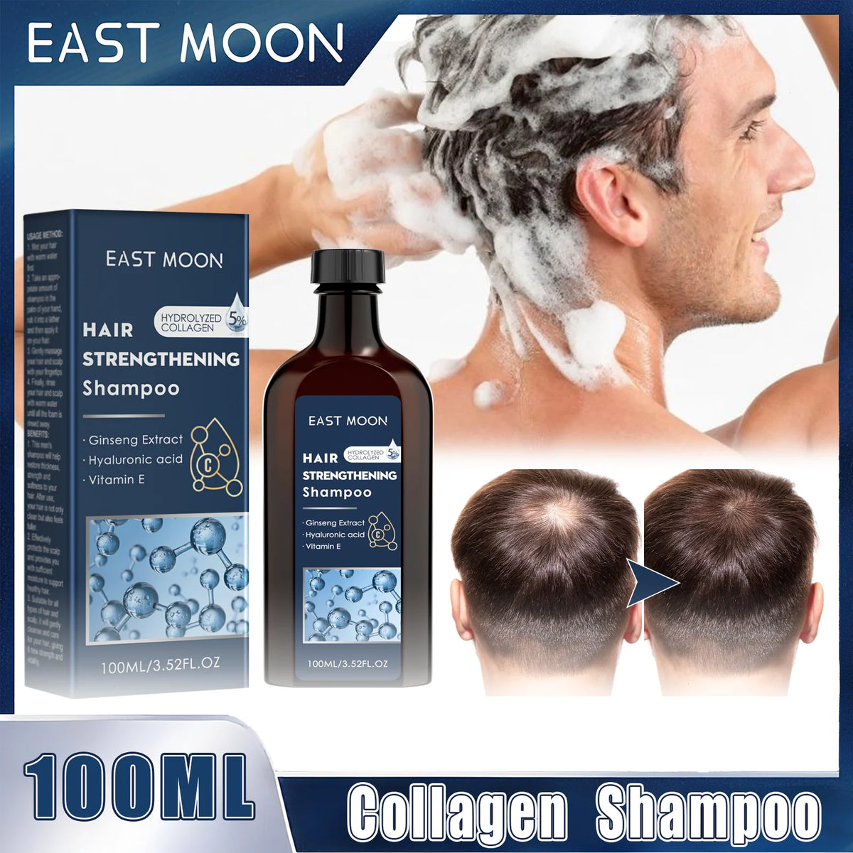 Collagen Shampoo Dandruff Control Oil Refreshing Nourishing Hair Root Repair Damaged Reduce Dry Shampoo Suitable For Men