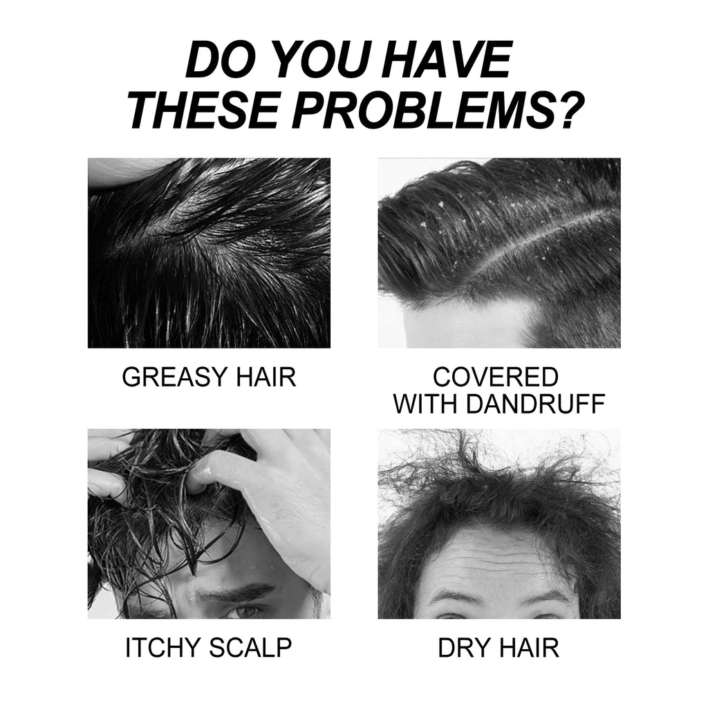Collagen Shampoo Dandruff Control Oil Refreshing Nourishing Hair Root Repair Damaged Reduce Dry Shampoo Suitable For Men