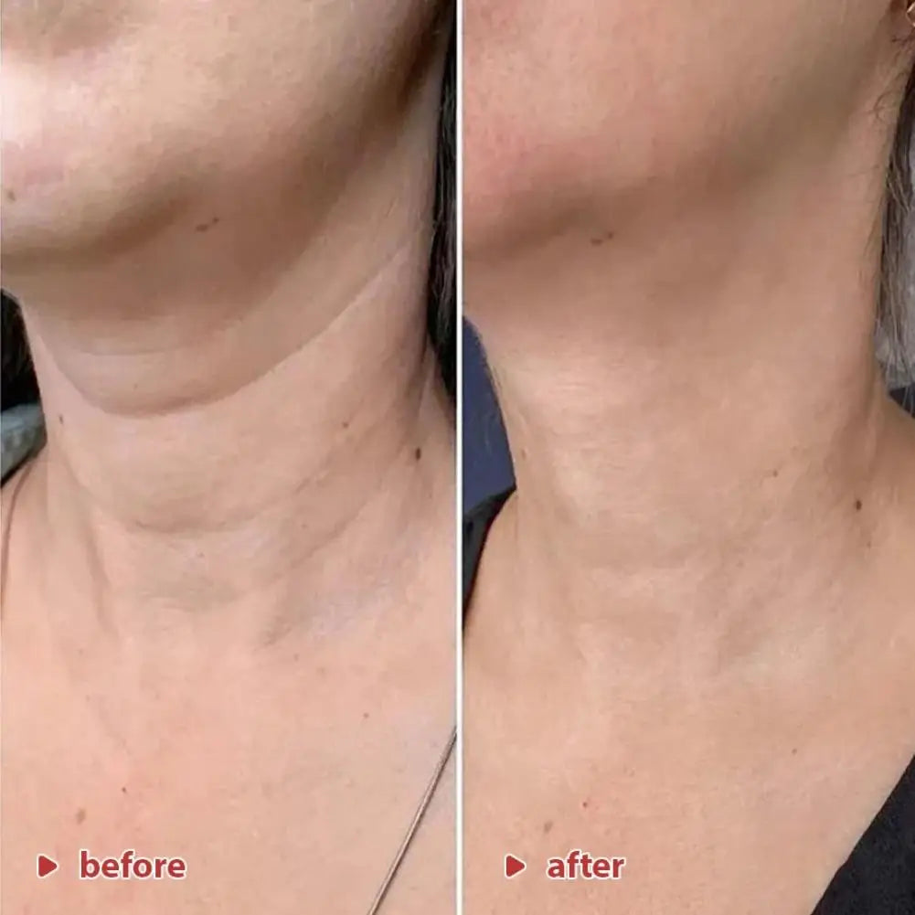Koriderm+ Time Reversal Neck Tightening Cream Tripeptide Retinol Smooth Double Chin Eliminate Neck Wrinkles Skin Care Cream