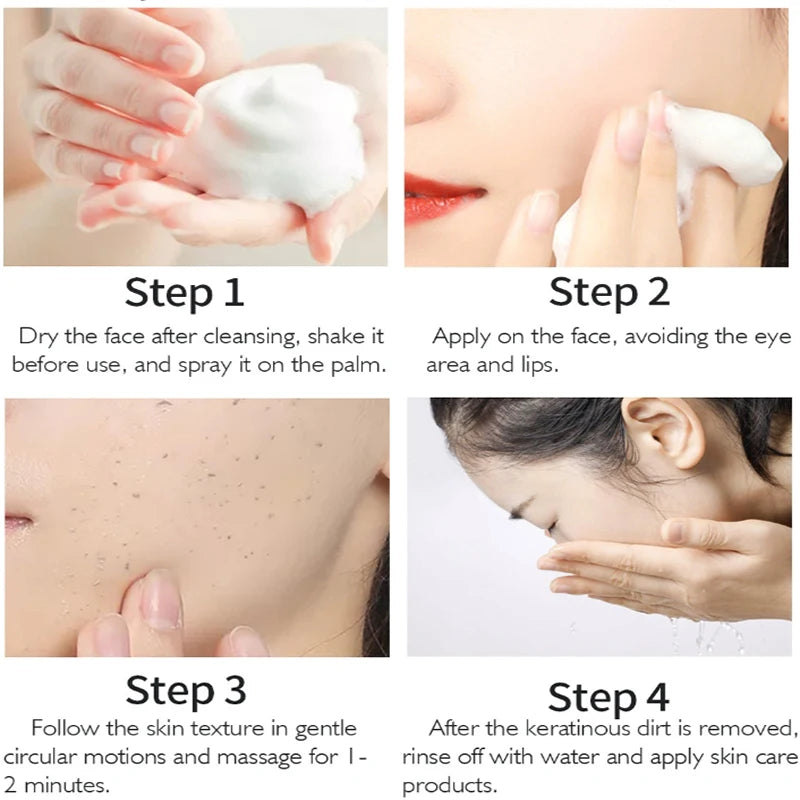 Exfoliating Mousse Improves Skin Texture Gentle Cleansing Makeup Dust Improves Enlarged Pores Oil-control Rosemary Cosmetics