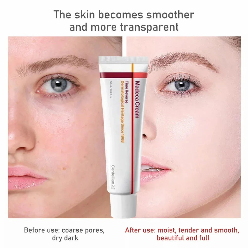 Madeca Centella Essence Moisturizing Cream Firming Nourishing Moisturizer Soothes The Repair The Skin Barrier Korean Skincare