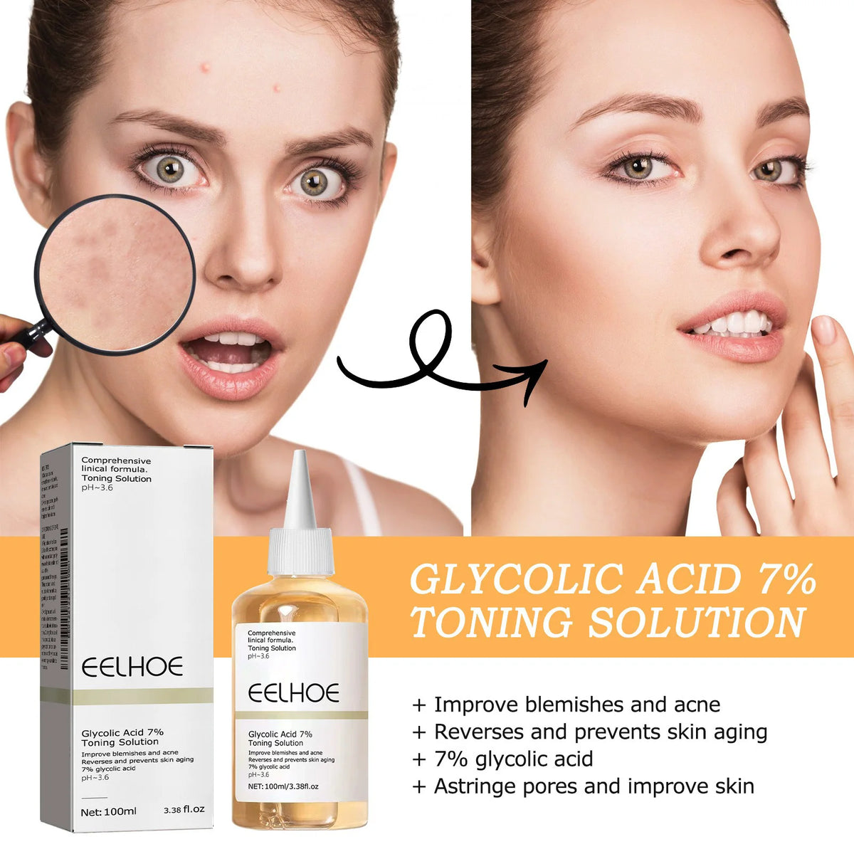Glycolic Acid 7% Toning Solution Ordinary Acne Remover Lifting Firming Wrinkles Glowing Facial Skin Care Glycolic Acid Toner