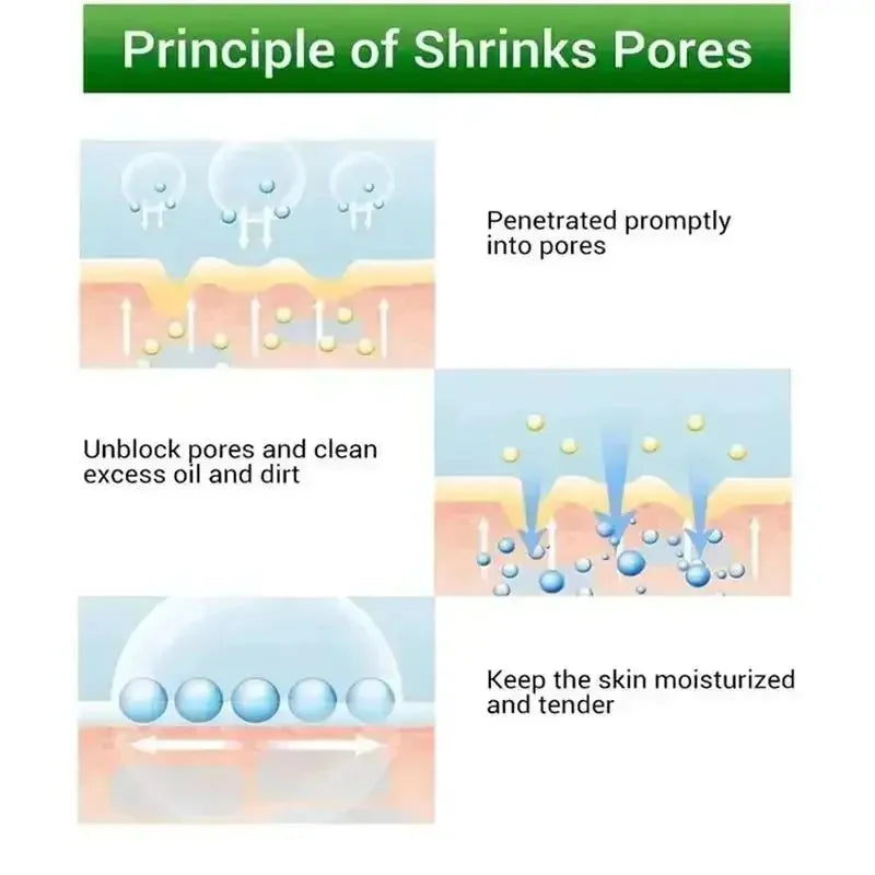 Salicylic Acid Pores Refining Cream Shrink Pore Lmprove Whitening Anti-aging Cream Face Acnes Cream 20g Skin Care