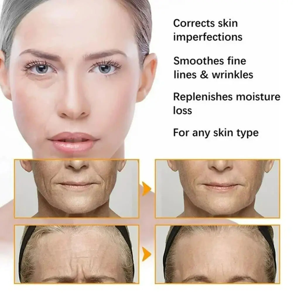 Firm Rejuvenating Skin Multi-Peptide Collagen Microneedling Serum Set Deep Moisturizing Brand Carvenchy Microinfusion Serum Kit