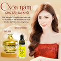 Kem Sam Serum Sua Rua Mat,3pcs Combo Kem Sâm Serum Cao CấP N Collagen Trang Da Tri Mun Nam 3mom, Remove Dark Skin Acne White