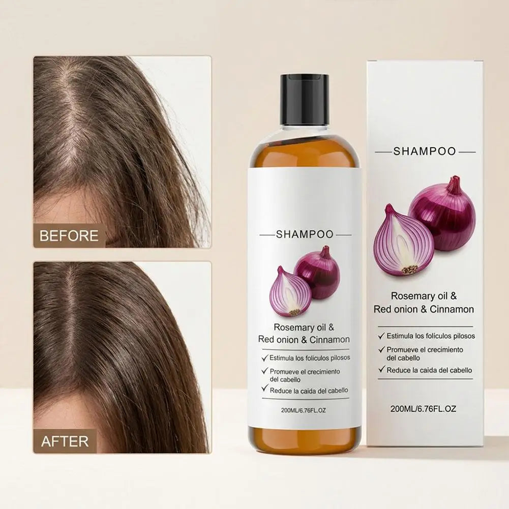 2/3pcs Rosemary Red Onion Shampoo Anti Hair Loss Promote Thicker Stronger excalvo Shampoo Hair Care 200ml