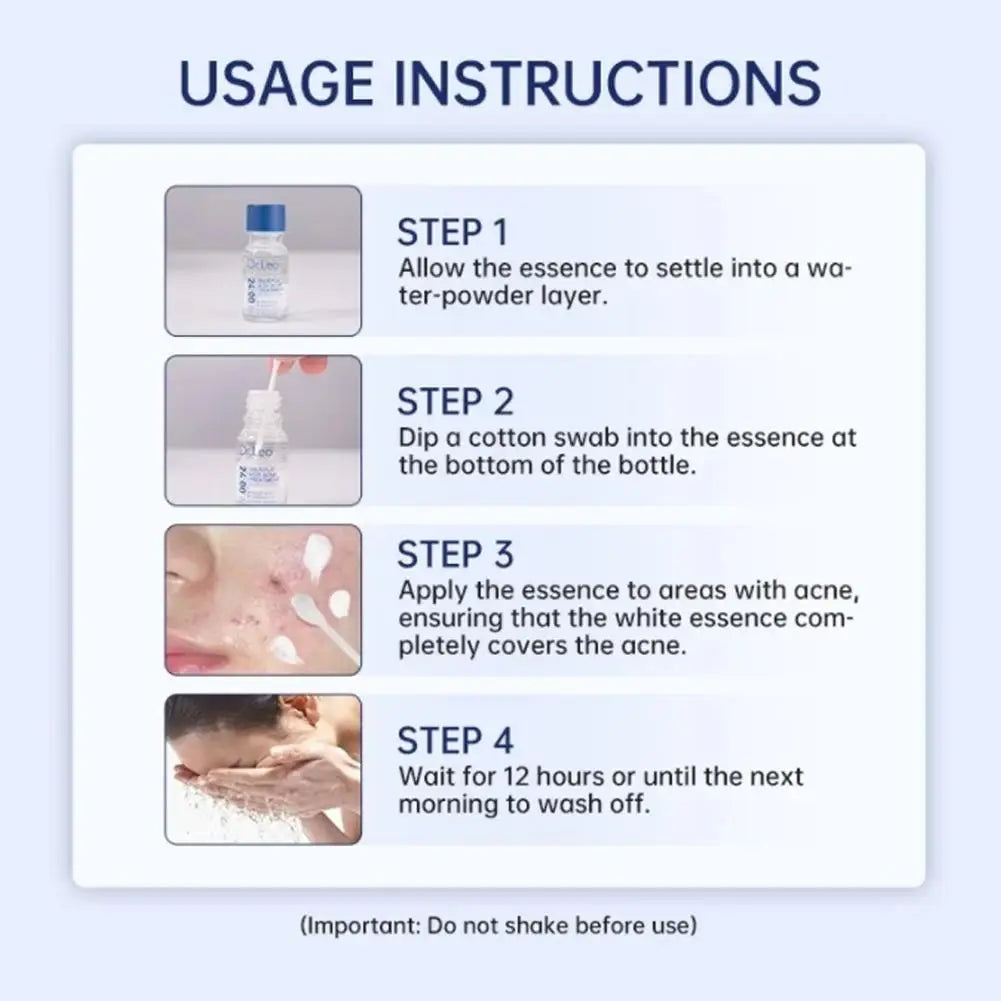 Salicylic Acid Acne Serum Pimple Spot Corrector Mandelic Acid Pore Refining Sebum Control Essence for Oily Blemish Skin