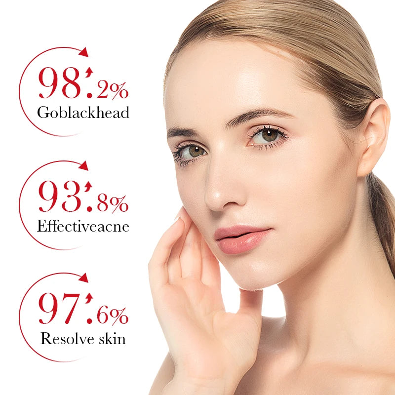 BIOAOUA Salicylic Acid Acne Cream Shrink Pore Cream Elimination Large Pores Remove Blackehead Repairing Skin Care Facial Cream