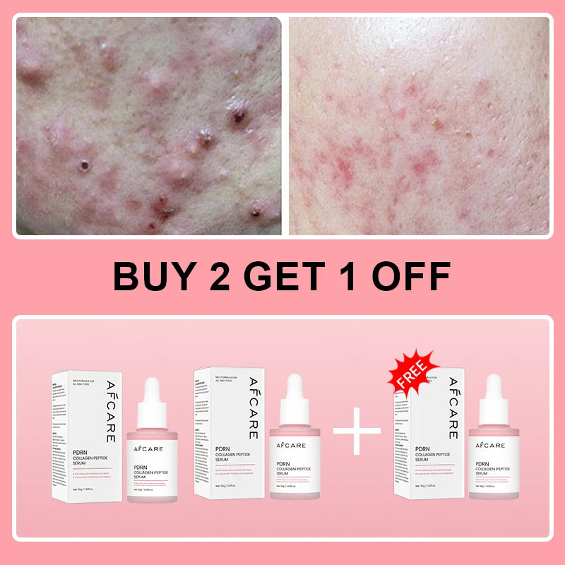 Collagen Peptide Facial Serum Targets Dull Skin Boosts Skin Elasticity Stimulates Skin Renewal Repair Salmon PDRN KOREAN Product