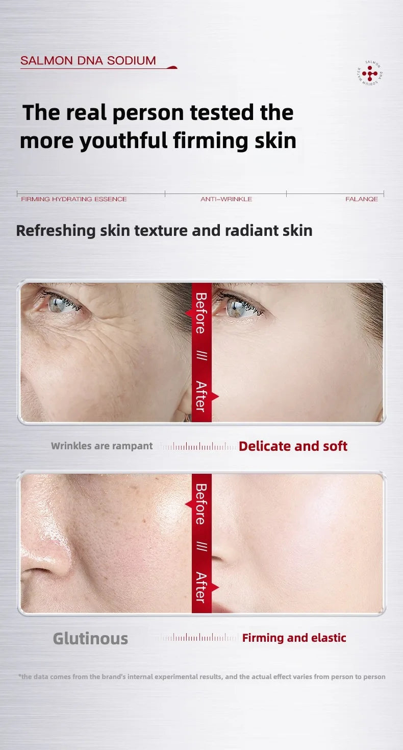 Salmon Dna Sodium Hydrating Kinetic Essence  Fade Fine Lines Facial Moisturizing brightning Anti Aging Firming Skin Care