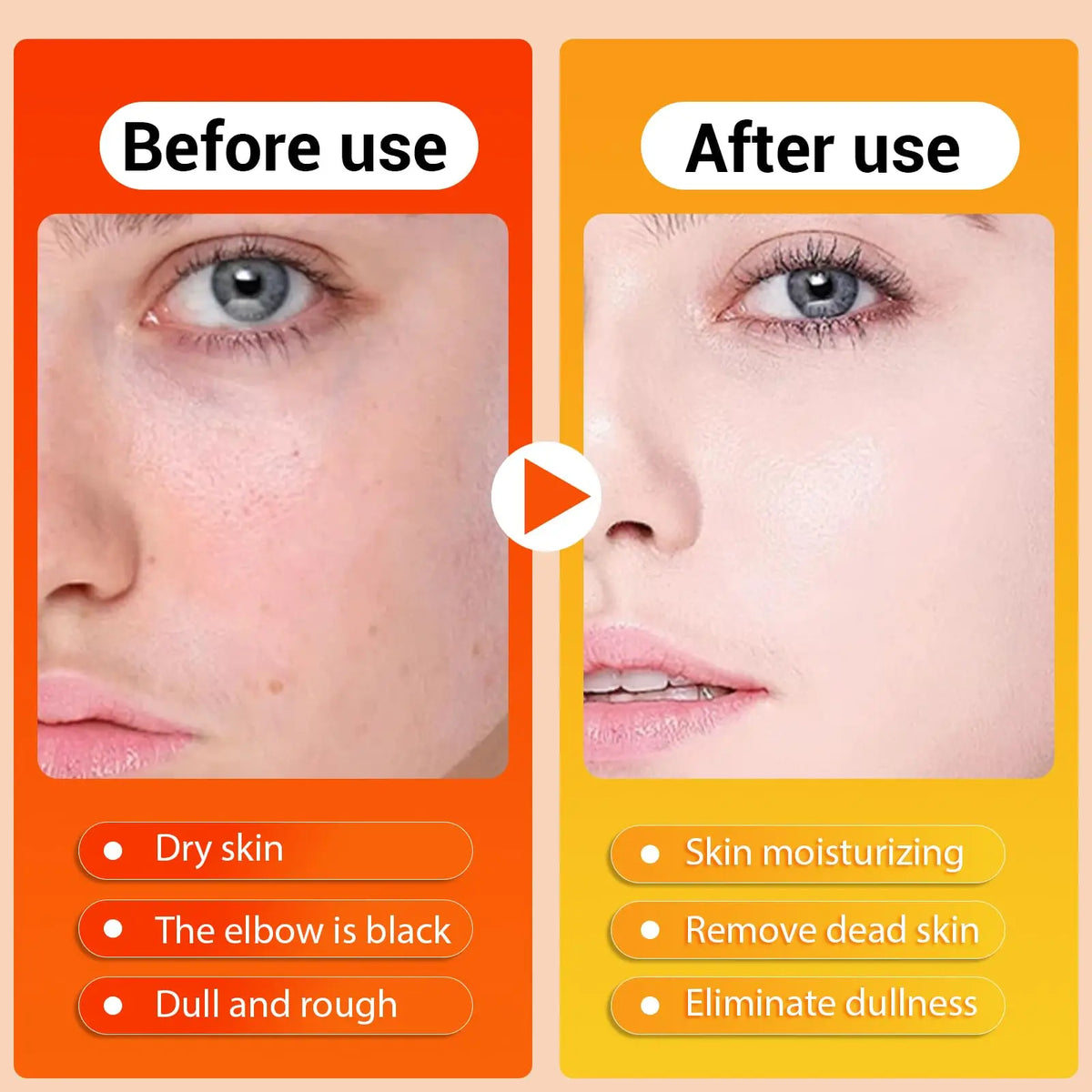 Keratin Care Kojic Acid Turmeric Spray Brightens Uneven Skin Tone Improves Dullness Full Body Use Skin Spray Smooth Skin