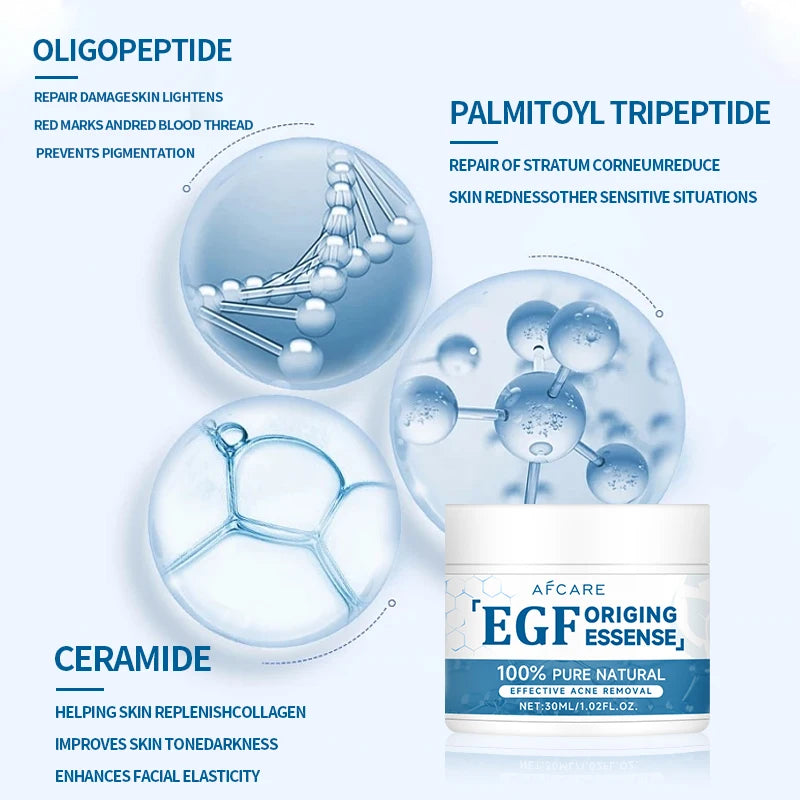 EGF Face Cream Acne Treatment Lightening Acne Remover Pimple Repair Skin Whitening Korean Skin Care Products Beauty Health